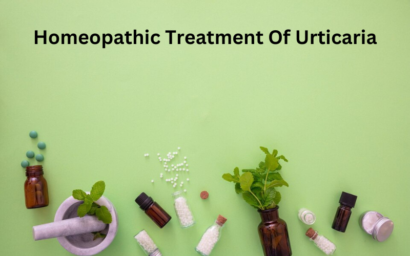 Homeopathic Treatment of Urticaria: Causes, Symptoms, and Remedies