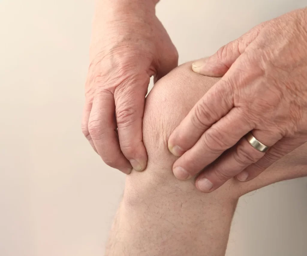 arthritis homeopathic treatment